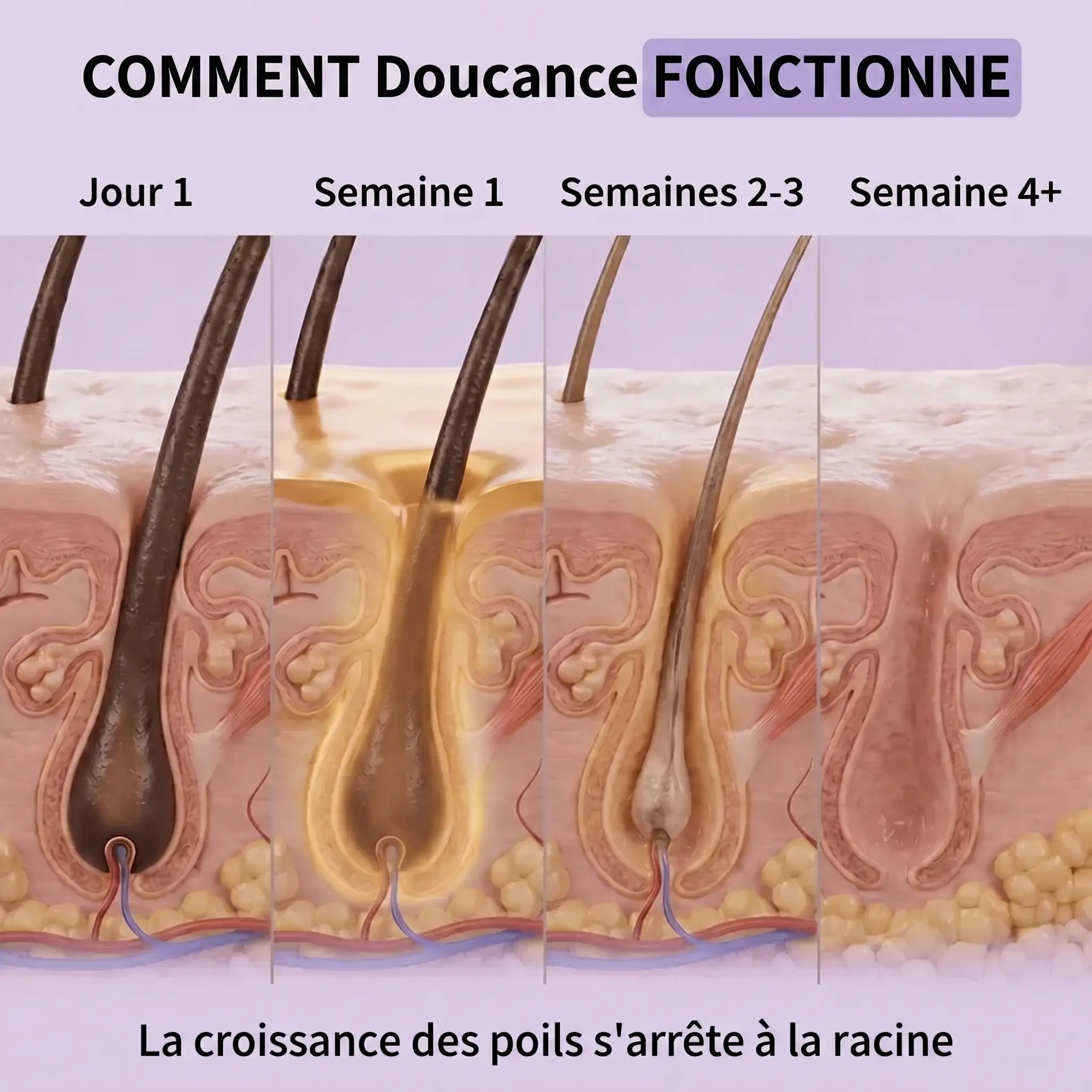Douceance - Sérum Anti Repousse